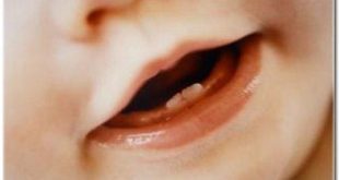 Dentes de leite podem gerar células-tronco para tratamento