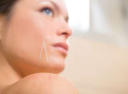 Além de tratar problemas como dores nas costas e ansiedade, a acupuntura também pode ser aplicada em prol da beleza feminina