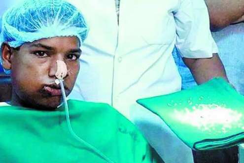 Em uma operação que durou sete horas, médicos da Índia extraíram 232 dentes da boca de um garoto de 17 anos.