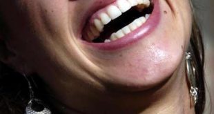 Brasil - Ministério da Saúde libera R$ 4,94 milhões para próteses dentárias
