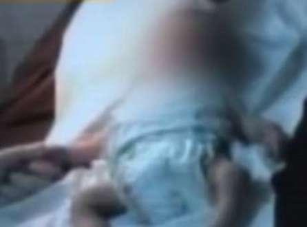 O bebê sofria de condições respiratórias graves