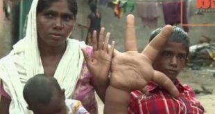 Kaleem vive com a família em região humilde, na Índia