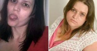 Em foto divulgada pela ativista, ela mostra a mudança que passou desde a época do vício até hoje, cinco anos sem a droga