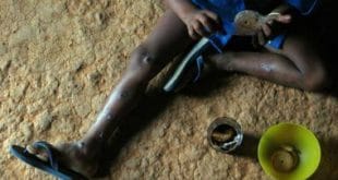 No caso do Brasil, a FAO cita o programa Fome Zero, que tem a participação de 19 ministérios e que ajudou a reduzir a pobreza de 24,3% a 8,4% entre 2001 e 2012