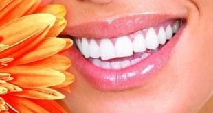 Curso - ABO promove curso gratuito de Marketing Odontológico em Montes Claros