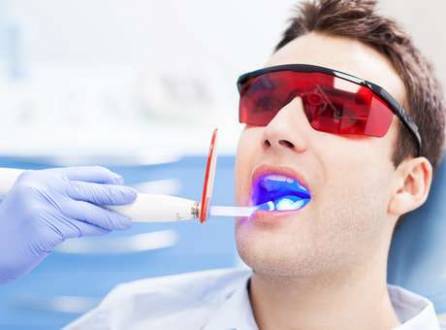 Quando a pessoa já tem um tom mais suave nos dentes, com apenas uma sessão que dura entre 40 minutos e 1h20, ela pode sair do consultório com os dentes brancos e satisfeita