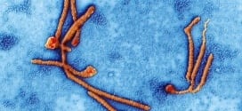 Brasil - Ministério Público Federal recomenda sigilo de dados de suspeitos de ebola