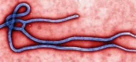 África - Ebola causou 5.420 mortes, afirma OMS