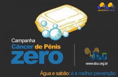 Saúde - Todo ano, mil homens têm o pênis amputado por causa de câncer