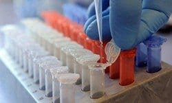 Saúde - Variante mais agressiva do HIV é descoberta em Cuba; especialistas estão preocupados