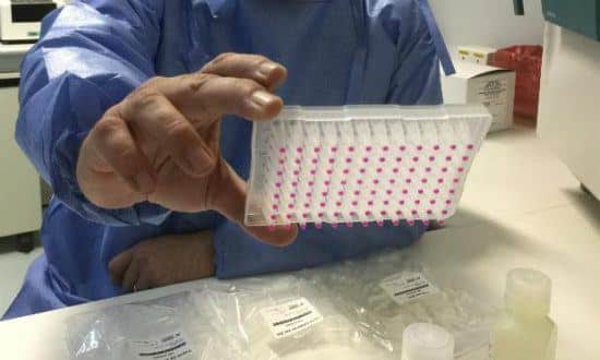 Inicialmente, os testes estarão disponíveis para pacientes do Hospital das Clínicas de Campinas e da rede pública municipal