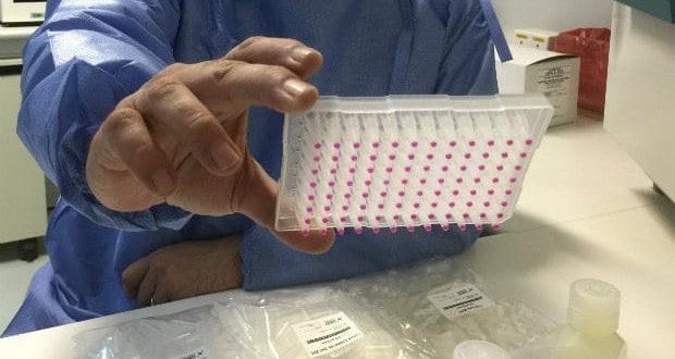 Inicialmente, os testes estarão disponíveis para pacientes do Hospital das Clínicas de Campinas e da rede pública municipal