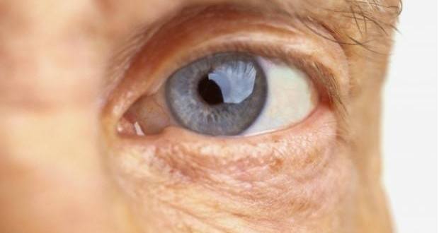 Atualmente, a cirurgia de catarata consiste na remoção do cristalino e sua substituição por uma lente artificial intraocular