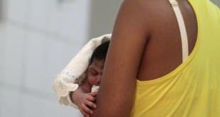 Casos de microcefalia crescem 5,1% no Brasil em uma semana