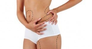 Beleza - Antes da cirurgia plástica é preciso discernimento com o corpo