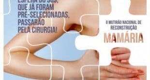 Montes Claros - Santa Casa de Montes Claros participa do II Mutirão Nacional de Reconstrução Mamária