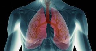 Montes Claros - A cidade de Montes Claros recebe mutirões para avaliação pulmonar gratuita