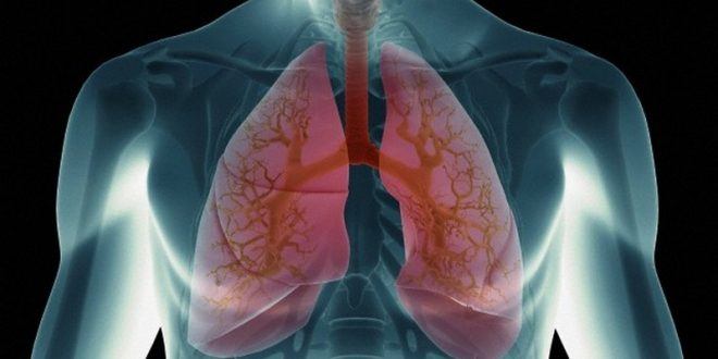 Montes Claros - A cidade de Montes Claros recebe mutirões para avaliação pulmonar gratuita