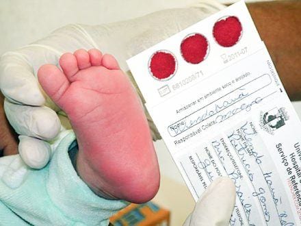 Saúde - Recém-nascidos devem fazer Teste do Pezinho até o 5º dia de vida