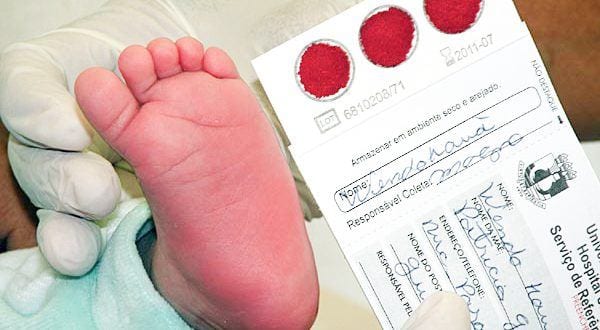 Saúde - Recém-nascidos devem fazer Teste do Pezinho até o 5º dia de vida