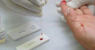 Montes Claros - Testes gratuitos de HIV nessa sexta-feira