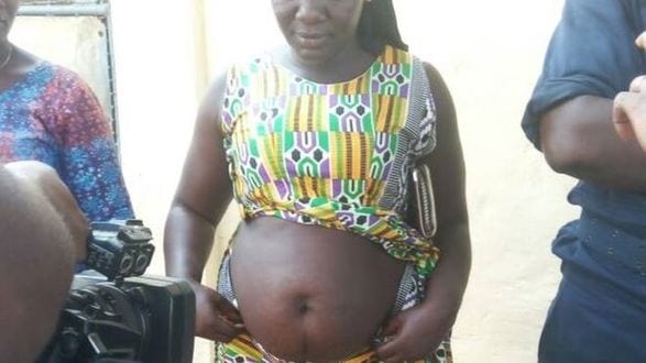 As ervas dadas pela curandeira faziam com que as mulheres ficassem com aspecto de gravidez | Foto: Alhassan Sillah/BBC