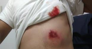 Militar estava com colete à prova de balas e teve apenas hematomas; policiais estavam em busca de suspeitos de furtar uma arma de fogo de um militar do Corpo de Bombeiros.