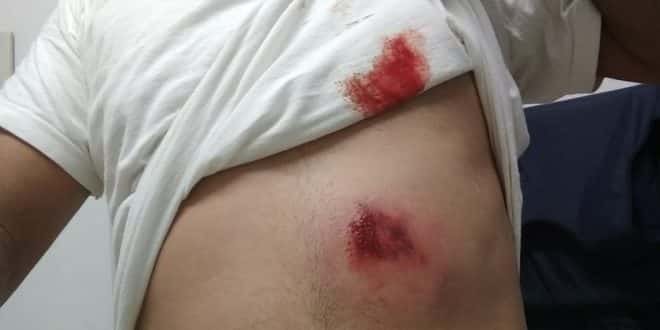 Militar estava com colete à prova de balas e teve apenas hematomas; policiais estavam em busca de suspeitos de furtar uma arma de fogo de um militar do Corpo de Bombeiros.