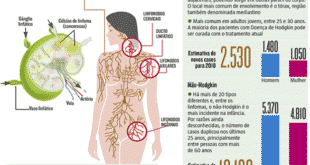 Saúde - Atento aos sinais dos linfomas