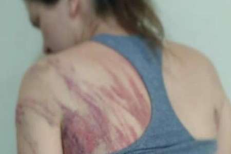 RJ - Mesmo abraçada ao filho, mulher é chicoteada com fio elétrico pelo marido