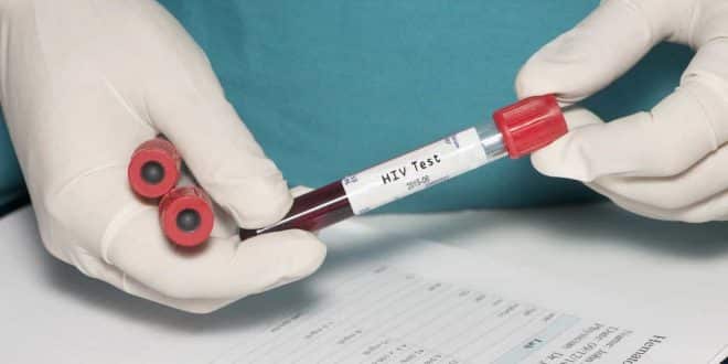 Saúde - Paciente londrino pode ser 2º no mundo a ficar livre da Aids