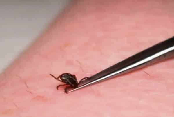 MG - Em Minas Gerais, Febre maculosa mata 4 em 10 doentes; autoridades estão em alerta
