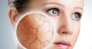 Beleza - Cuidados que você precisa ter com a pele no inverno