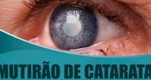 Norte de Minas - Mais 1,5 mil cirurgias de catarata serão feitas no Norte de Minas