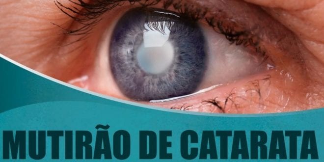 Norte de Minas - Mais 1,5 mil cirurgias de catarata serão feitas no Norte de Minas