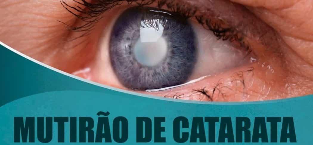 Norte de Minas - Mais 1,5 mil cirurgias de catarata serão feitas no Norte de Minas