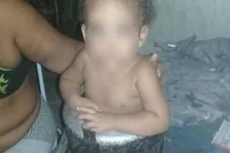 Criança de um ano fica presa dentro de panela de pressão