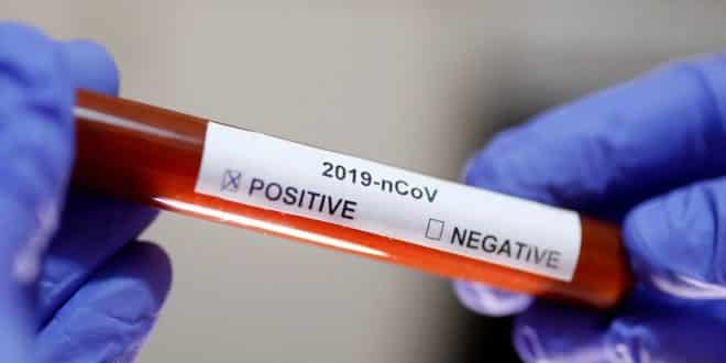 MG - Número de casos confirmados de Coronavírus deve subir em Minas Gerais com chegada de kits para exames