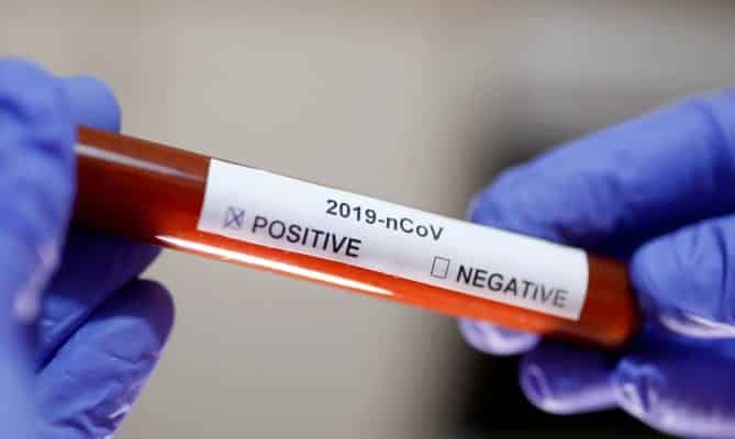 MG - Minas Gerais tem 655 casos confirmados para Covid-19 e 15 mortes