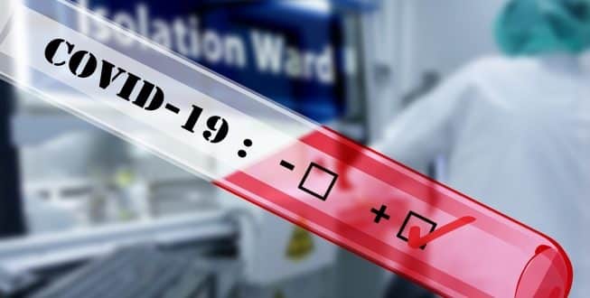 Chegam ao Brasil lote de 500 mil testes para diagnóstico da Covid-19