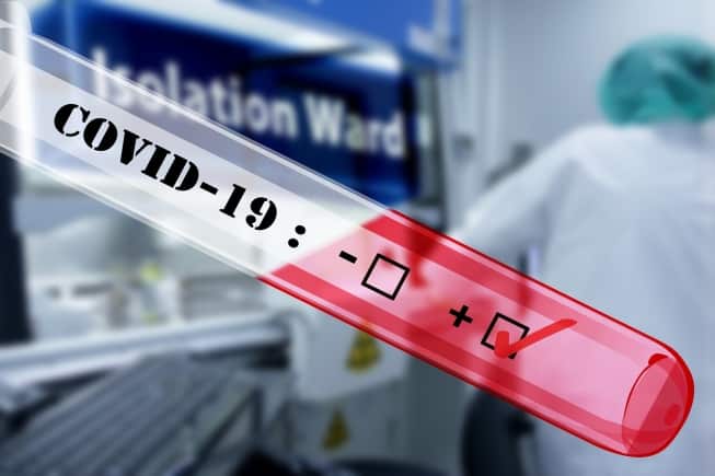 Chegam ao Brasil lote de 500 mil testes para diagnóstico da Covid-19