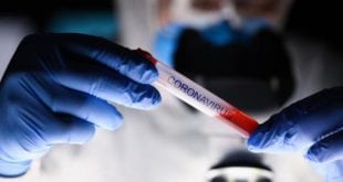 Montes Claros - Prefeitura orienta responsáveis por farmácias e drogarias sobre os testes rápidos para COVID-19