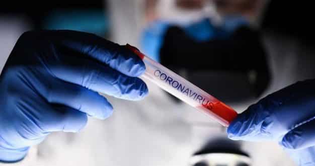 Montes Claros - Prefeitura orienta responsáveis por farmácias e drogarias sobre os testes rápidos para COVID-19