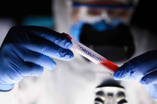 Montes Claros - Prefeitura orienta responsáveis por farmácias e drogarias sobre os testes rápidos para COVID-19