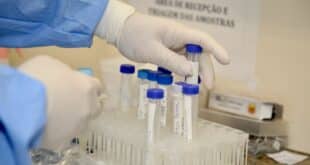 Infectados com a Covid-19 devem repetir exame diagnóstico após 14 dias do contágio, diz especialista