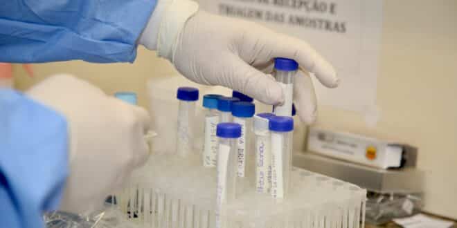 Infectados com a Covid-19 devem repetir exame diagnóstico após 14 dias do contágio, diz especialista