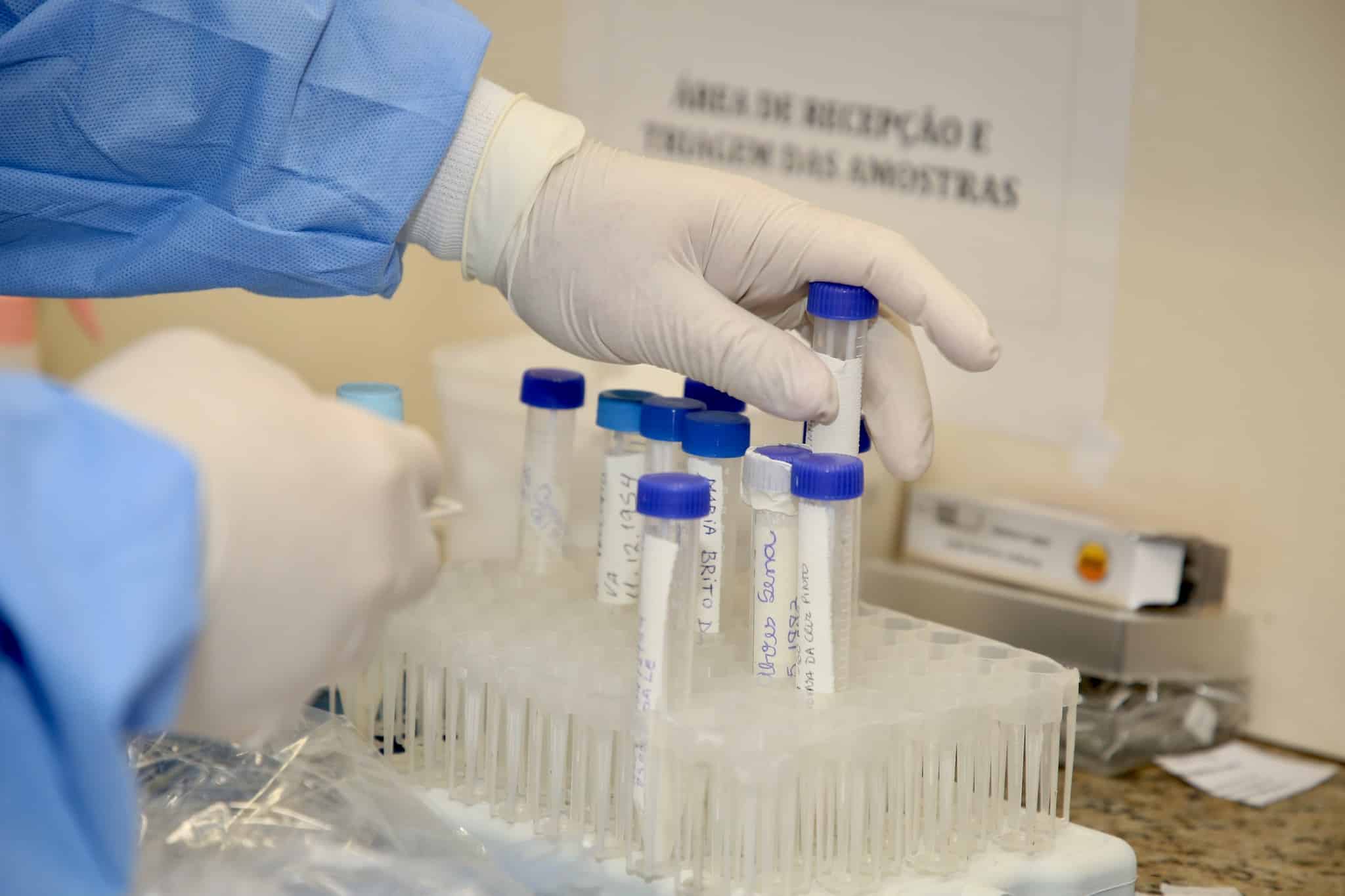 Infectados com a Covid-19 devem repetir exame diagnóstico após 14 dias do contágio, diz especialista