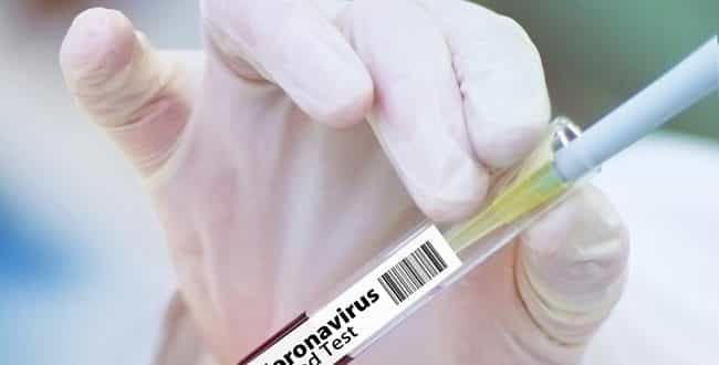 Norte de Minas - Casos confirmados de coronavírus assustam moradores de Janaúba
