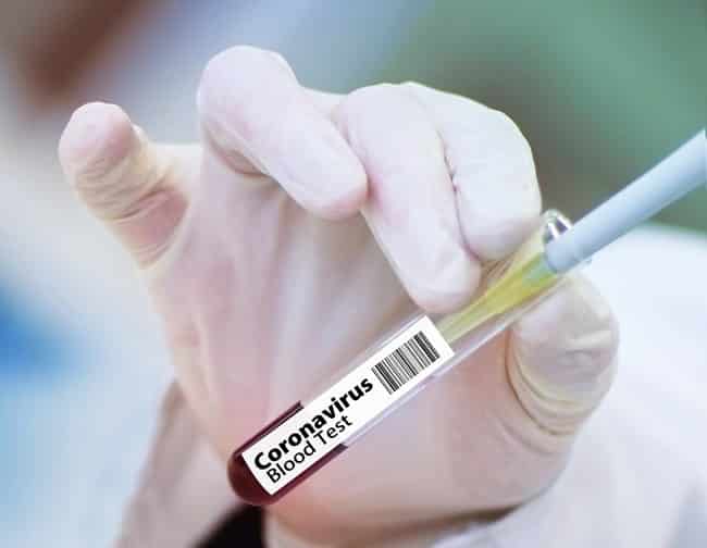 Norte de Minas - Casos confirmados de coronavírus assustam moradores de Janaúba