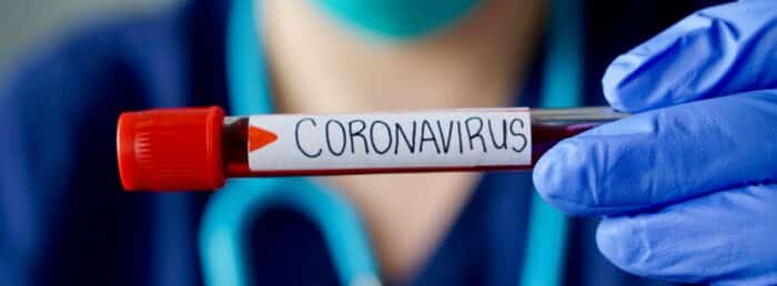 Começam os testes da vacina contra o novo coronavírus no Brasil